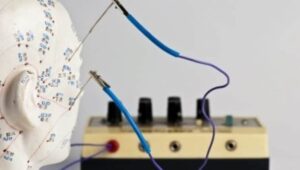 Acupuncture Reduces High Blood Pressure