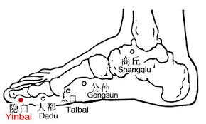 Moxibustion & Acupuncture for Menorrhagia
