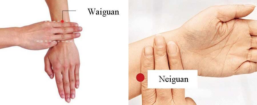 acupuncture for ankle sprain