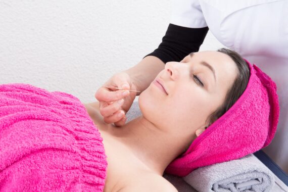 facial acupuncture