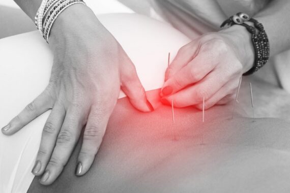 pain relief
