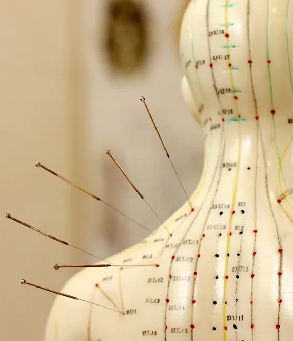 acupuncture points