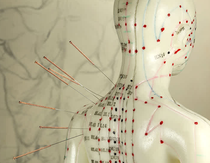 Acupuncture Treatment for Shoulder Pain Acupuncture Treatment for Shoulder Pain