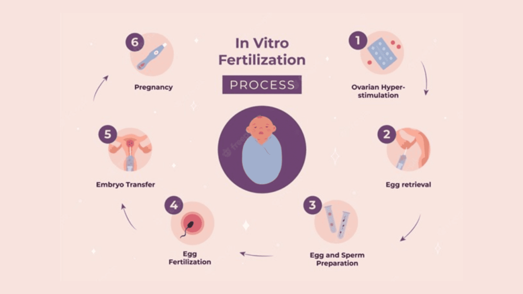 IVF