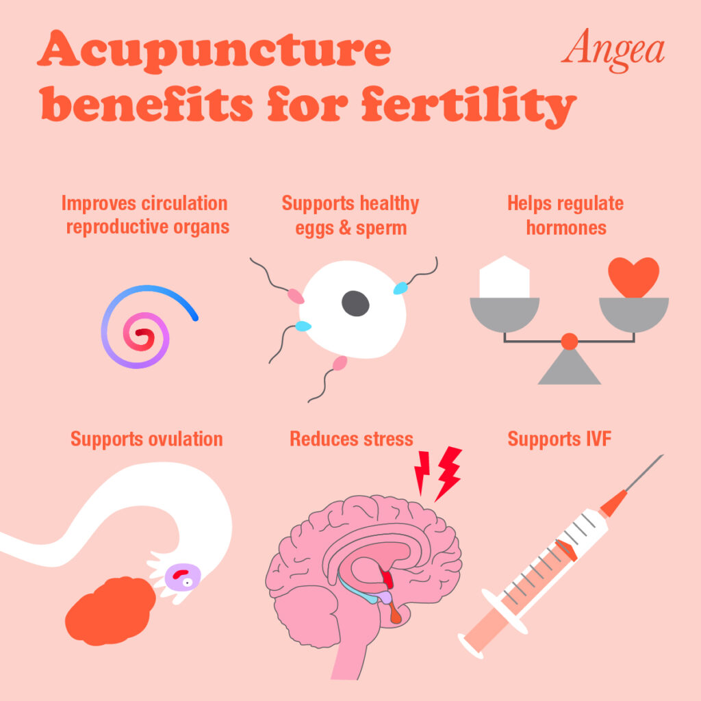 Acupuncture and IVF