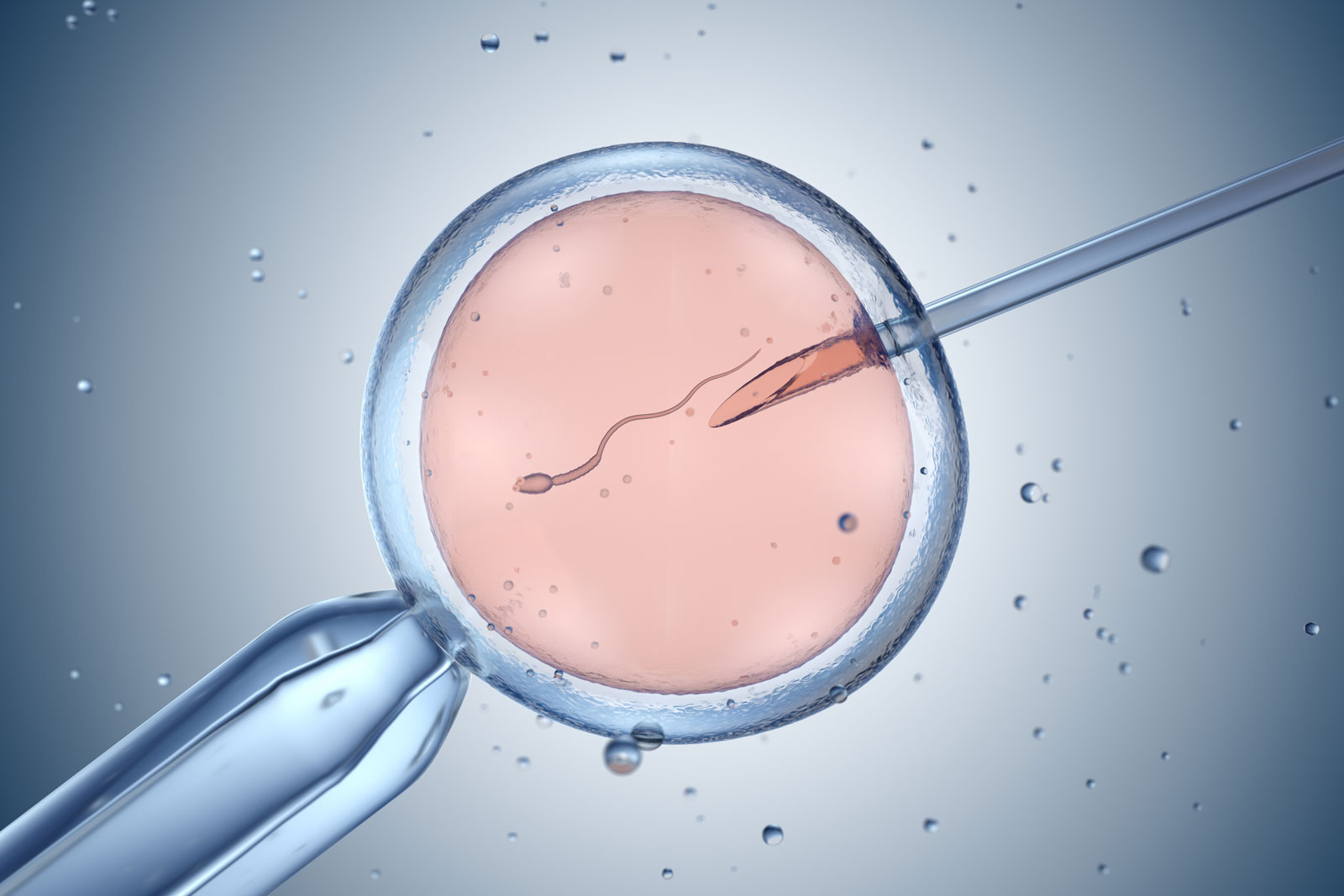 fertility acupuncture