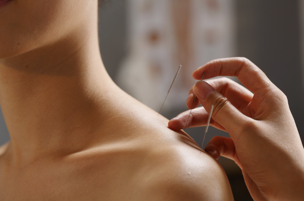Screenshot 2026-09-11 at 4.51.42 PM acupuncture for shoulder and neck pain